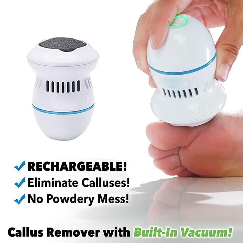 Vacuuming Foot Callus Remover - Dave's Deal Depot